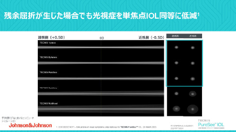 �c�]���܂��������ꍇ�ł������ǂ�P�œ_IOL�����ɒጸ